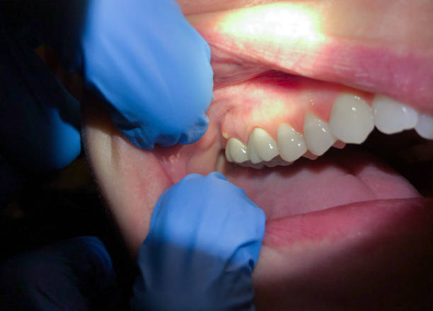 Best Pediatric Emergency Dentist in Honey Grove, TX