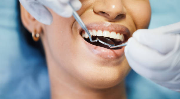 Best Mobile Emergency Dentist in Honey Grove, TX