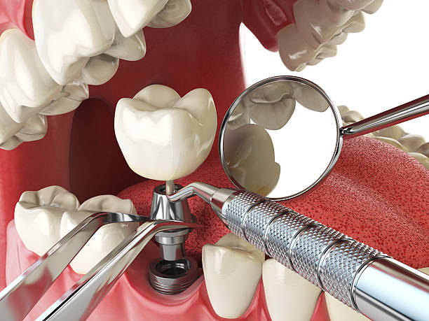 Best Emergency Dental Care for Abscessed Tooth in Honey Grove, TX